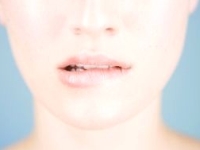A-vitamin, retinol A-vitamin, retinol
