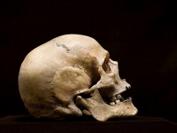 agyműtét agyműtét
