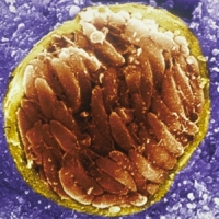 toxoplazma
