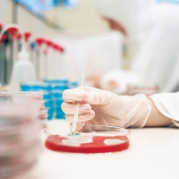 toxoplazmózis, bélbaktériumok toxoplazmózis, bélbaktériumok
