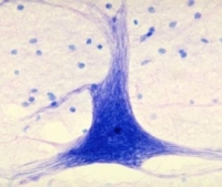 idegsejtek, ideggyulladás, neuropathia idegsejtek, ideggyulladás, neuropathia