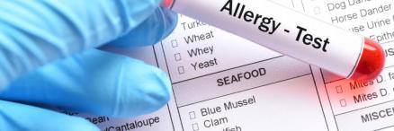 Allergia teszt melyik