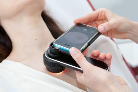 Melanoma anyajegyszűrés dermatoszkóp okostelefon Melanoma anyajegyszűrés dermatoszkóp okostelefon