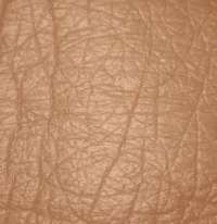 bőrátültetés, transzplantáció bőrátültetés, transzplantáció