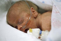 császármetszés újszülött koraszülött légzésprobléma