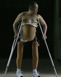 félbevágott ember műláb biomechanikus művégtag félbevágott ember műláb biomechanikus művégtag