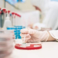 antibiotikumok, baktériumok, tbc antibiotikumok, baktériumok, tbc