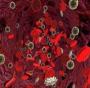 ferritin
