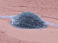 fotoakusztikus tomográfia fotoakusztikus tomográfia