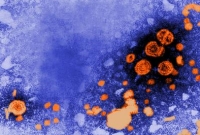 hepatitis B-vírus hepatitis B-vírus