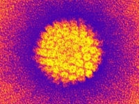 méhnyakrák, HPV-teszt méhnyakrák, HPV-teszt