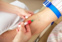 HIV-teszt HIV-teszt