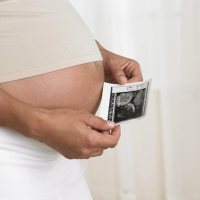 terhesség, Doppler, ultrahang