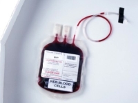 vérátömlesztés