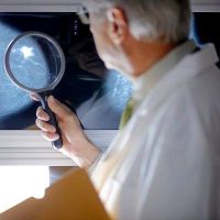 mammográfia mammogram lelet radiológus mammográfia mammogram lelet radiológus
