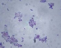 Staphylococcus aureus baktérium homoszexuális