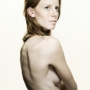 anorexia nervosa