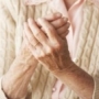 arthritis