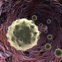 fehérvérsejt, melanoma fehérvérsejt, melanoma