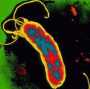 Gyomorfekély, helicobacter pylori Gyomorfekély, helicobacter pylori