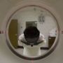 agy hiányzó agyfélteke mri felvétel vizsgálat neurológia agy hiányzó agyfélteke mri felvétel vizsgálat neurológia